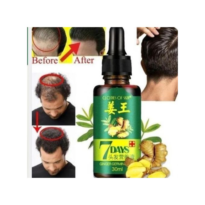 🔥 SALE — 7Days Ginger Hair Growth Oil 30ml | Stop Hair Loss + Regrow in 7 Days | Men & Women | KSh 1,400