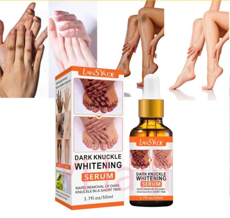 🔥 LIMITED DEAL — LansYade Dark Knuckle Whitening Serum 50ml | Fades Dark Knuckles + Brightens Elbows & Knees + Evens Skin Tone | KSh 1,500