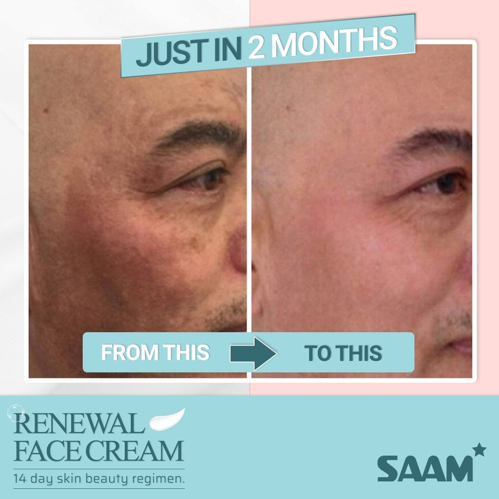 🔥 ORDER 1, WE SEND 2 — SAAM Renewal Face Cream | Anti-Ageing + Deep Hydration + Glowing Skin | KSh 4,500