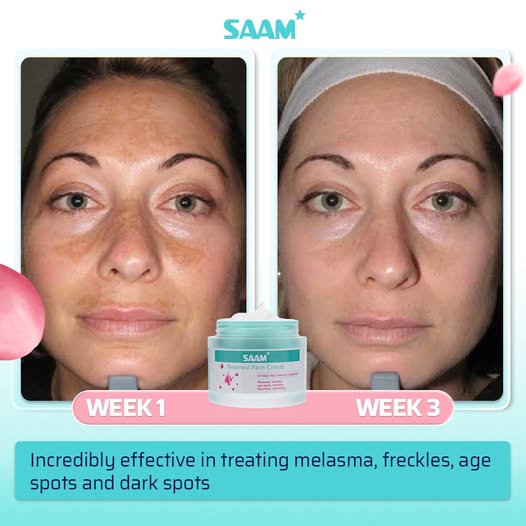 🔥ORIGINAL Saam Renewal Face Cream with QR CODE , BUY 1 GET 1 EXTRA FREE 🔥