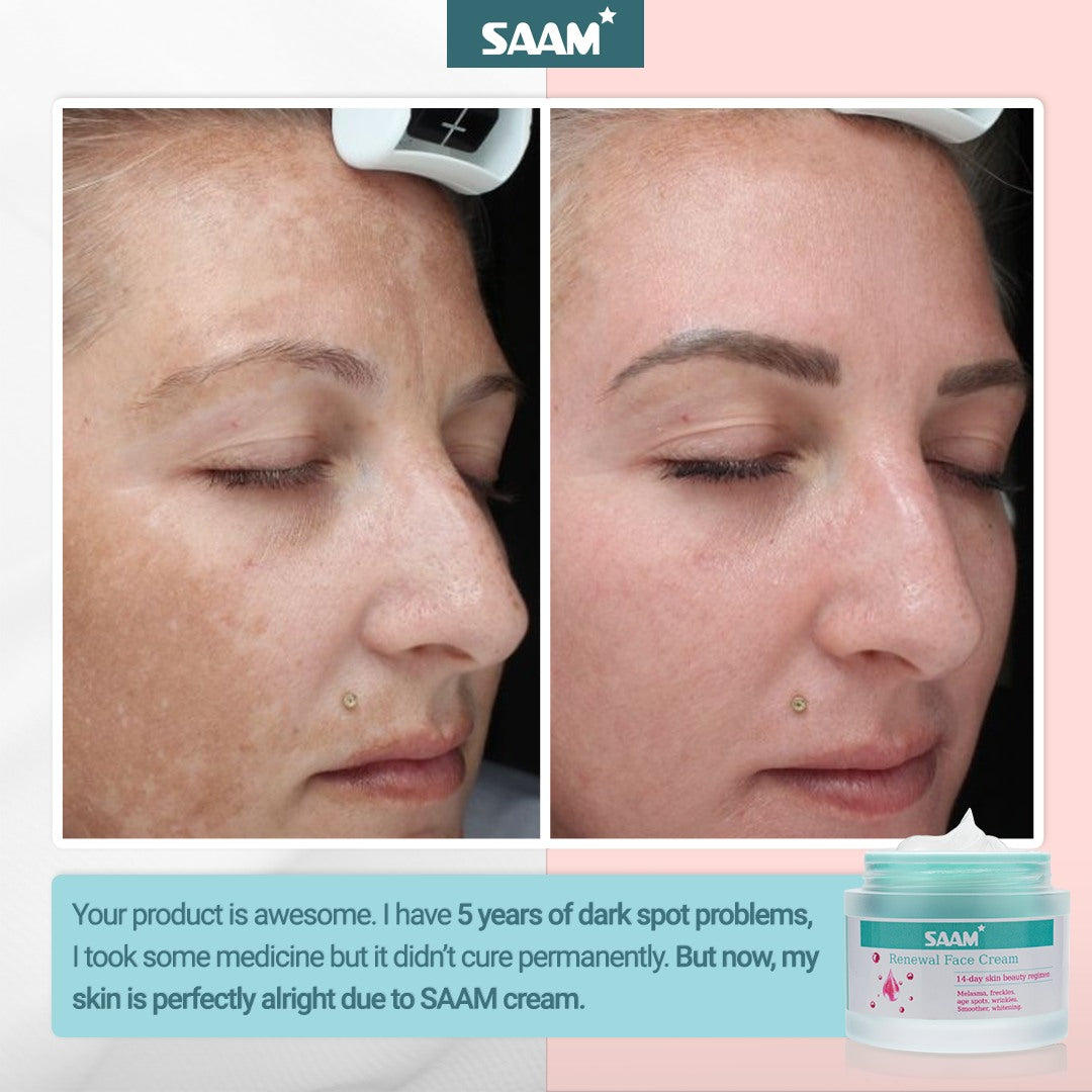 🔥ORIGINAL Saam Renewal Face Cream with QR CODE , BUY 1 GET 1 EXTRA FREE 🔥