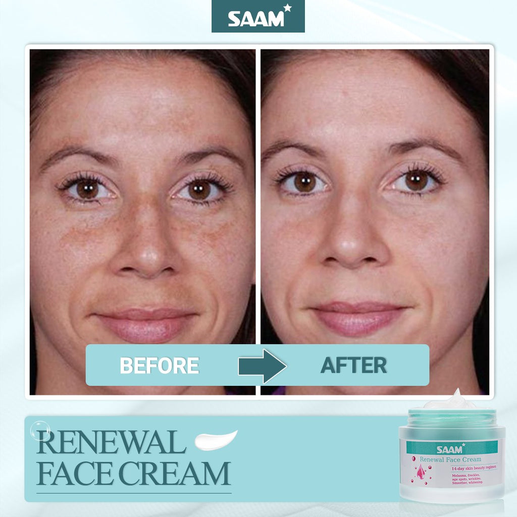 🔥ORIGINAL Saam Renewal Face Cream with QR CODE , BUY 1 GET 1 EXTRA FREE 🔥