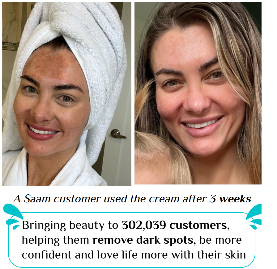🔥 ORDER 1, WE SEND 2 — SAAM Renewal Face Cream | Anti-Ageing + Deep Hydration + Glowing Skin | KSh 4,500