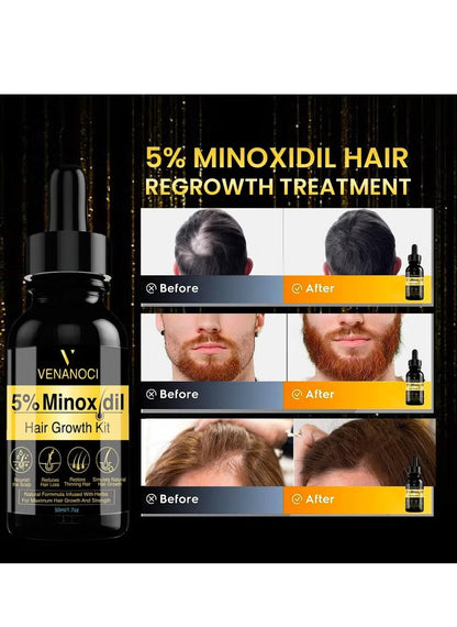 Olivita 5% Minoxidil Beard & Hair Growth Serum Kit for Men – 50 ml