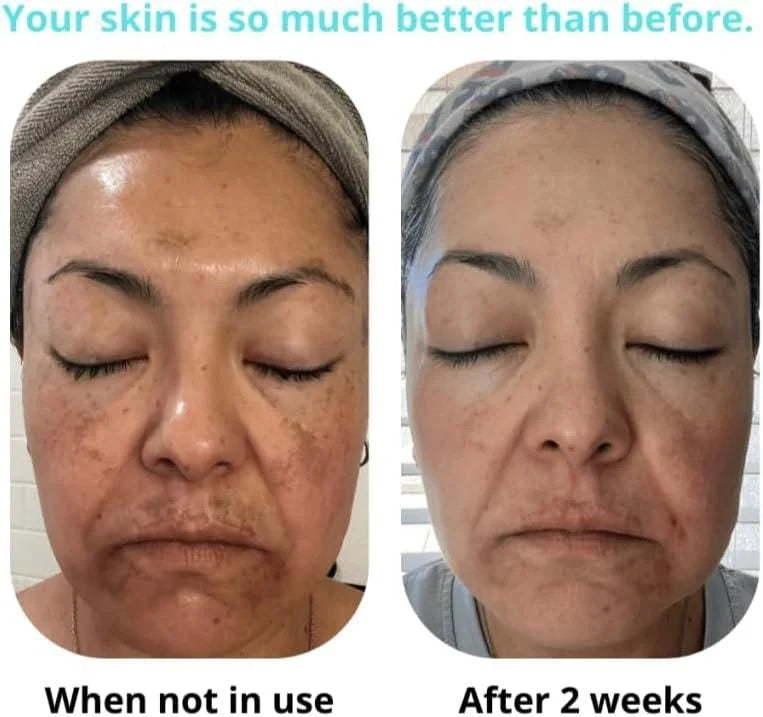 🔥ORIGINAL Saam Renewal Face Cream with QR CODE , BUY 1 GET 1 EXTRA FREE 🔥