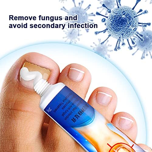 🔥 Sumifun Nail Fungus Treatment Cream – Fast Relief for Nail Fungus, Discoloration & Thick Nails | Restore Healthy Nails Naturally