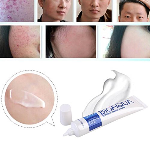 🔥 LIMITED DEAL — BIOAQUA Acne Removal Rejuvenation Cream | Clear Pimples + Fade Scars + Renew Skin | KSh 2000