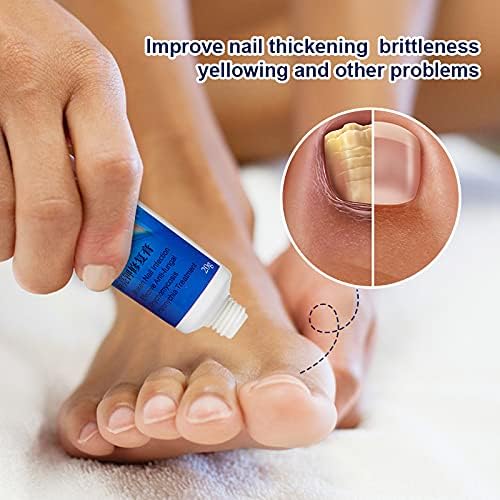 🔥 Sumifun Nail Fungus Treatment Cream – Fast Relief for Nail Fungus, Discoloration & Thick Nails | Restore Healthy Nails Naturally