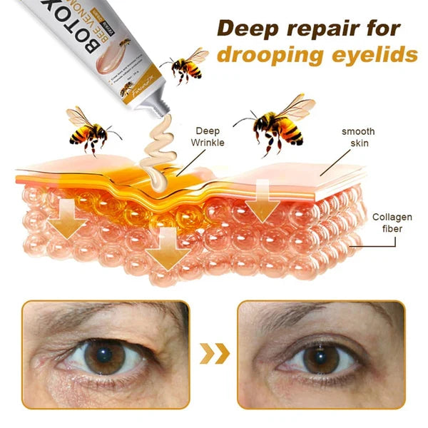🔥 LIMITED DEAL — Botox Bee Venom Anti-Wrinkle Cream | Lifts & Firms + Erases Fine Lines + Restores Youthful Glow | KSh 2,000