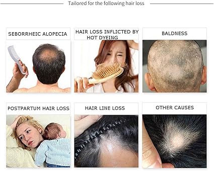 🔥 ORDER 1, WE SEND 2 — Disaar Hair Growth Essential Oil 30g | Stops Hair Loss + Regrows Thinning Hair + Nourishes Scalp | KSh 1,800