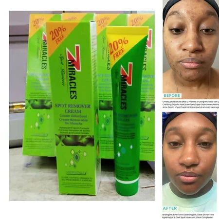 🔥 LIMITED DEAL — 7 Miracles Spot Remover Cream | Clears Dark Spots + Evens Skin Tone + Brightens & Smooths | KSh 1,200