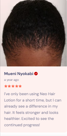 🔥 LIMITED DEAL — Neo Hair Lotion (Thailand) | Stops Hair Loss + Regrows + Strengthens Roots | KSh 4,500