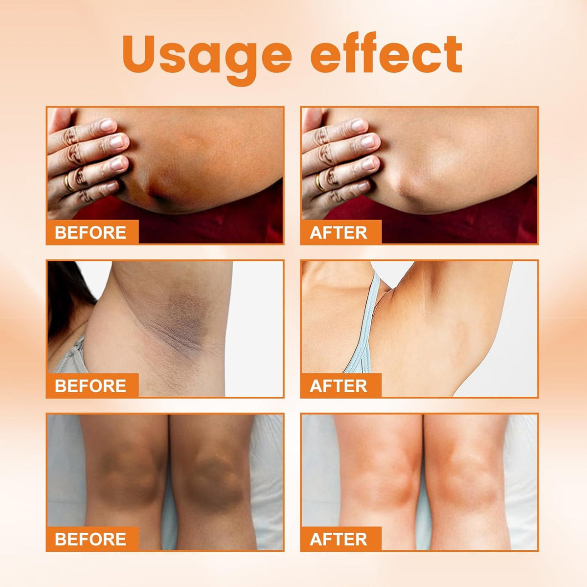 🔥 LIMITED DEAL — SADOER Vitamin C Whitening Cream | Brighten + Fade Dark Spots + Anti-Ageing + Hydrate | KSh 1,600
