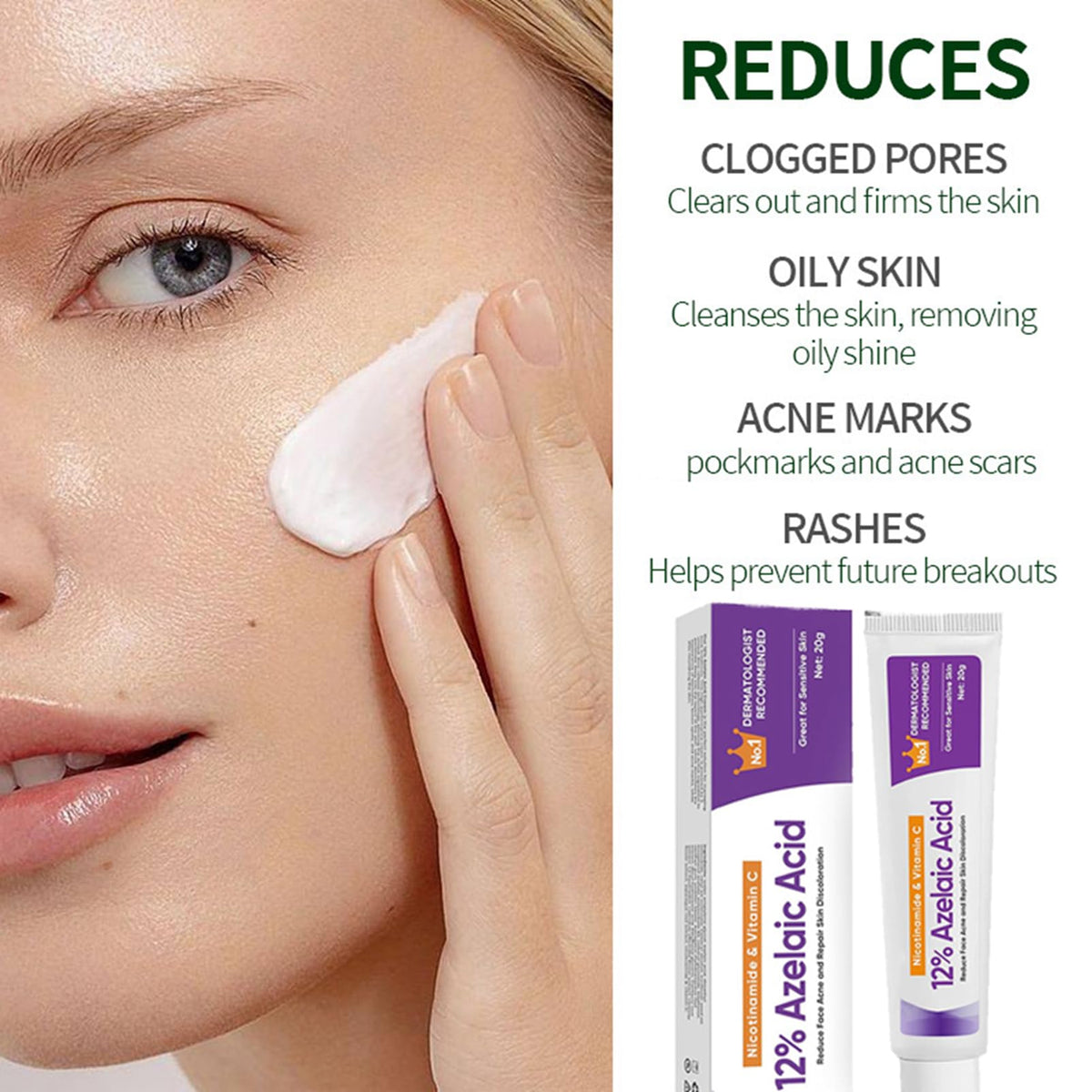 Sauvasine Azelaic Acid 12% Facial Cream with Hyaluronic Acid & Niacinamide – Fade Dark Spots, Acne & Redness C