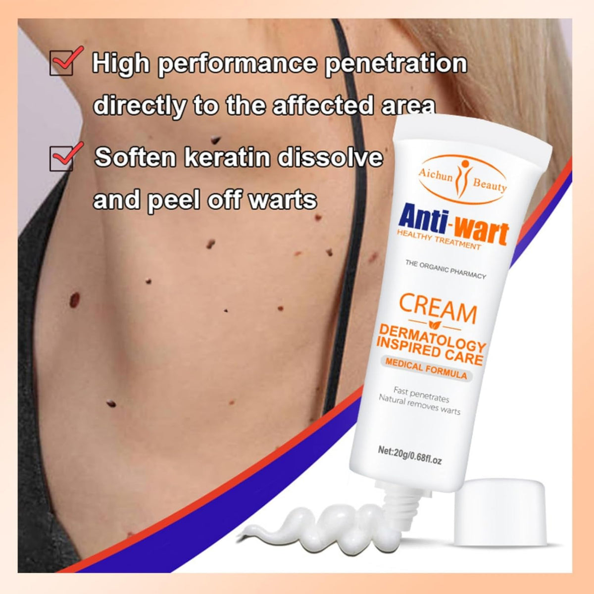 🔥 LIMITED DEAL — Aichun Beauty Anti-Wart Cream | Removes Warts + Skin Tags + Prevents Recurrence | KSh 1,800