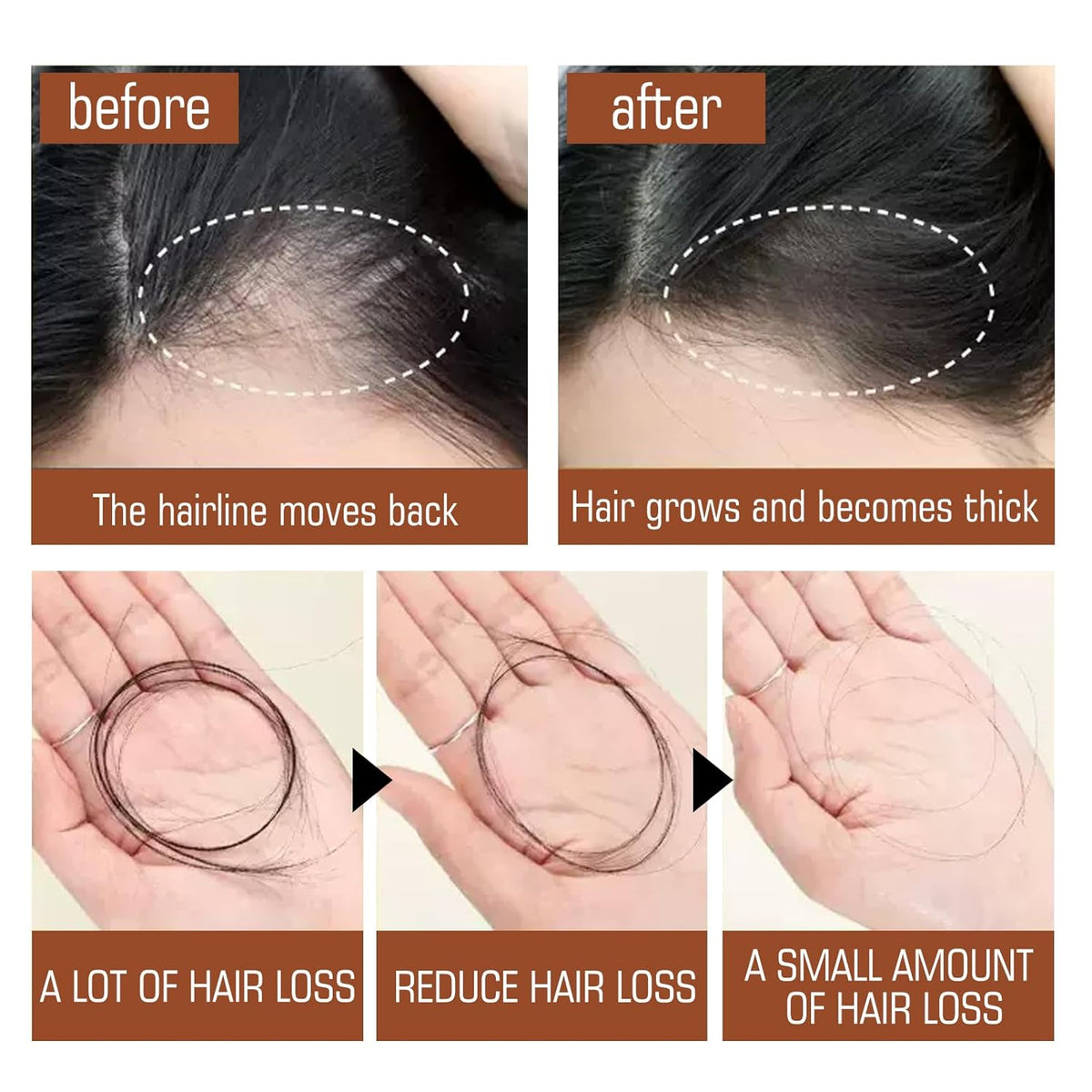 🔥 SALE — EELHOE Batana Oil | Stop Hair Breakage + Grow Thicker Hair | Limited Stock KSh 2,500