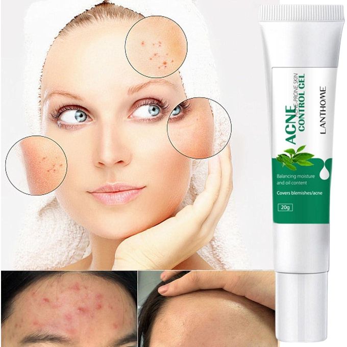🔥 LIMITED DEAL — Lanthome Acne Control Gel 20g | Clears Pimples + Fades Blemishes + Smooths Skin | KSh 1,800