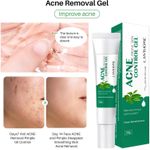 🔥 LIMITED DEAL — Lanthome Acne Control Gel 20g | Clears Pimples + Fades Blemishes + Smooths Skin | KSh 1,800