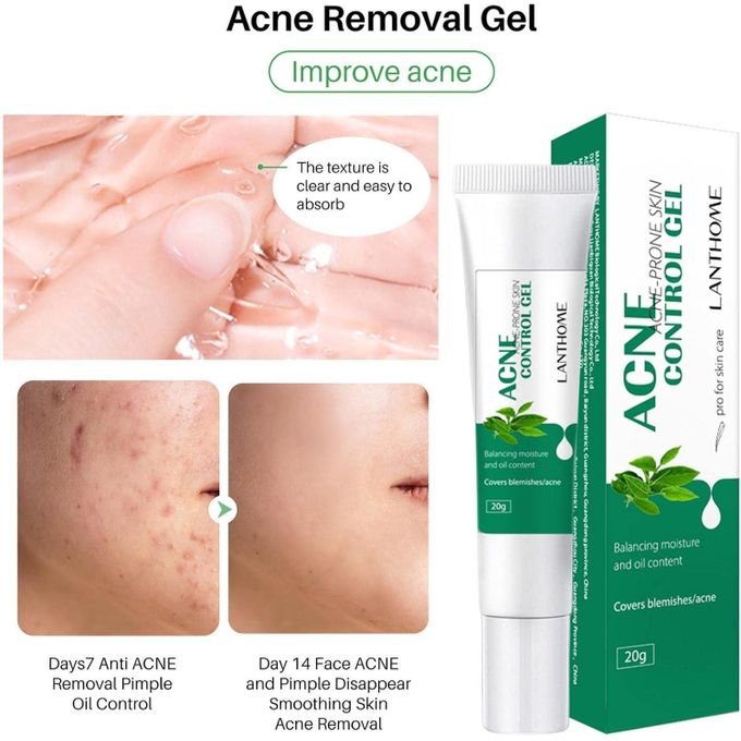 🔥 LIMITED DEAL — Lanthome Acne Control Gel 20g | Clears Pimples + Fades Blemishes + Smooths Skin | KSh 1,800