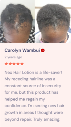 🔥 LIMITED DEAL — Neo Hair Lotion (Thailand) | Stops Hair Loss + Regrows + Strengthens Roots | KSh 4,500