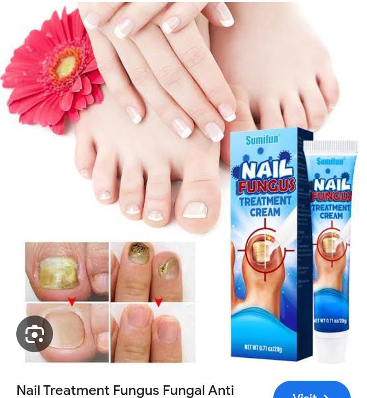 🔥 Sumifun Nail Fungus Treatment Cream – Fast Relief for Nail Fungus, Discoloration & Thick Nails | Restore Healthy Nails Naturally