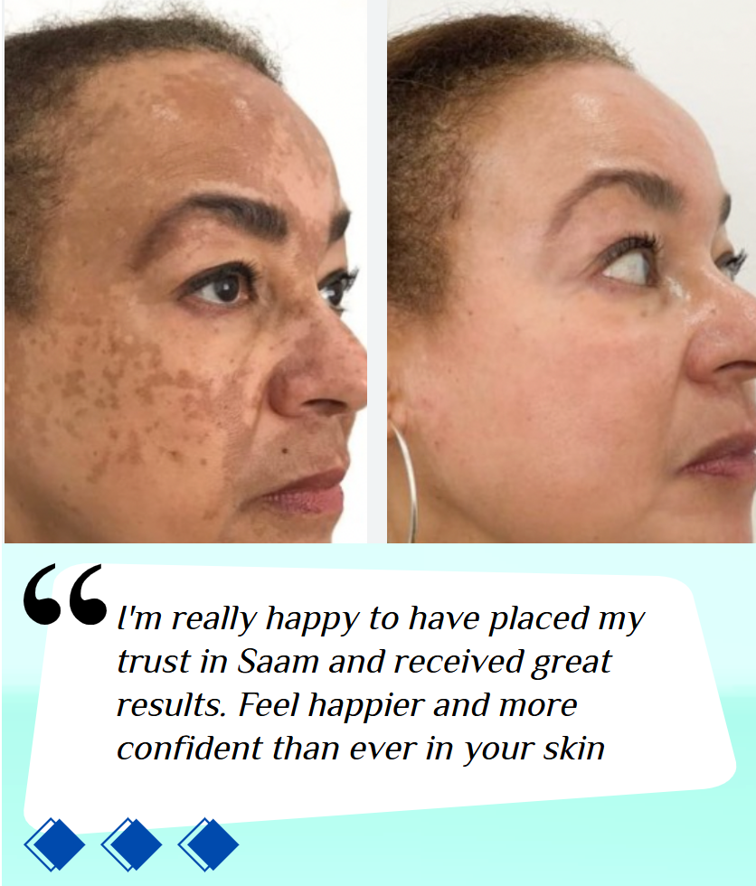 🔥 ORDER 1, WE SEND 2 — SAAM Renewal Face Cream | Anti-Ageing + Deep Hydration + Glowing Skin | KSh 4,500