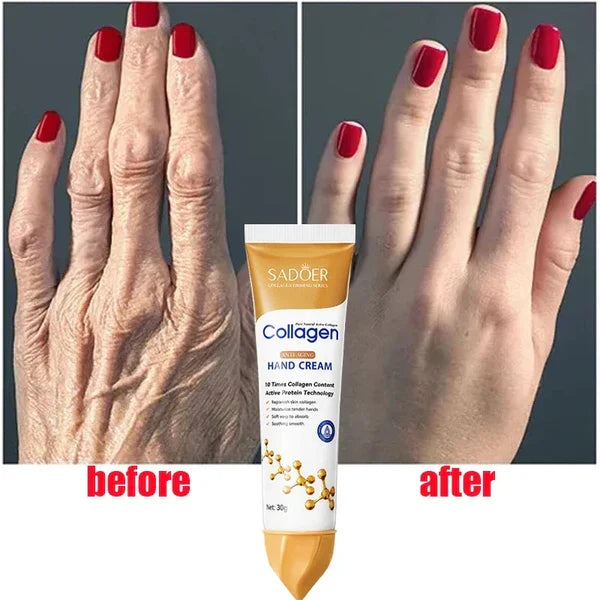 🔥 ORDER 1, WE SEND 2 — SADOER Collagen Hands Cream 30g | Anti-Ageing + Wrinkles + Dark Spots + Deep Hydration | KSh 1,500