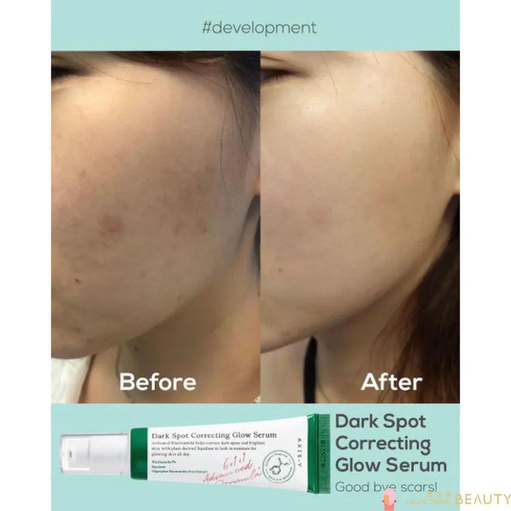 🔥 LIMITED DEAL — AXIS-Y Dark Spot Correcting Glow Serum 50ml | Fades Dark Spots & Hyperpigmentation + Niacinamide & Vitamin C + Radiant Glow | KSh 2,750