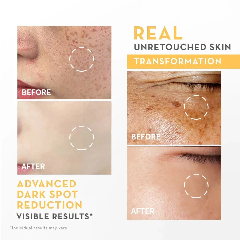 🔥 LIMITED DEAL — Garnier Bright Complete 30x Vitamin C + Niacinamide Booster Serum | Brightening + Acne Mark Fading + Even Tone | KSh 1,900