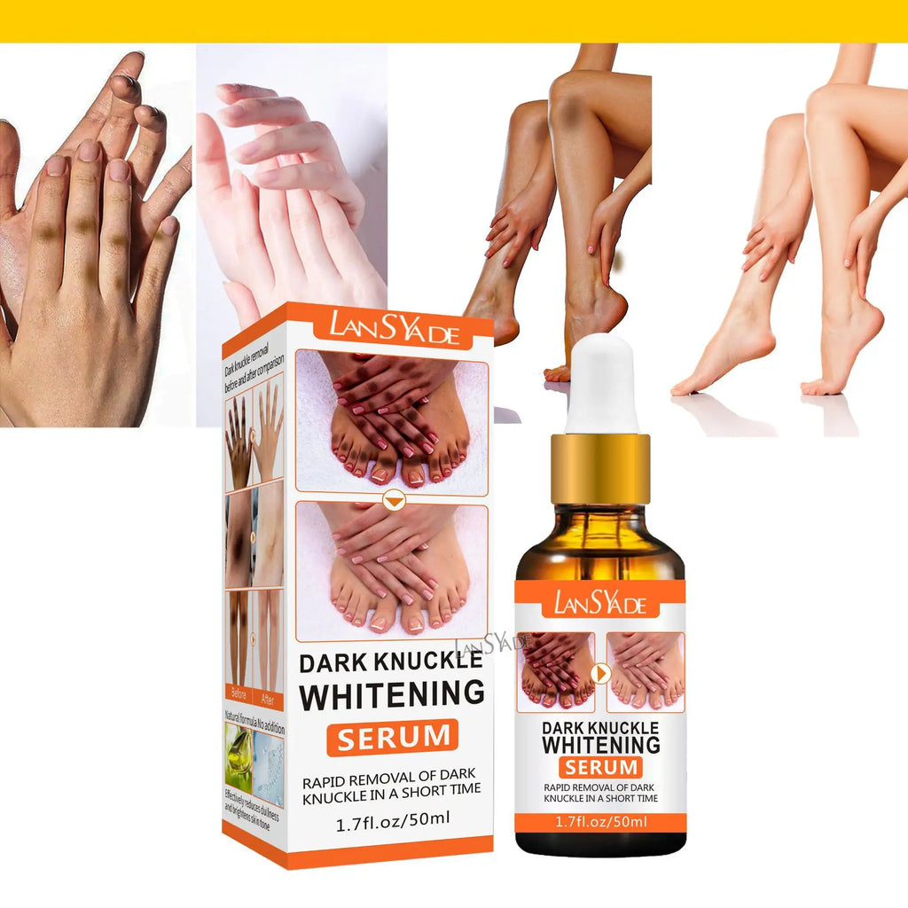 🔥 LIMITED DEAL — LansYade Dark Knuckle Whitening Serum 50ml | Fades Dark Knuckles + Brightens Elbows & Knees + Evens Skin Tone | KSh 1,500