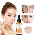 🔥 ORDER 1, WE SEND 2 — Aichun Beauty Carrot Whitening Serum 30ml | Brightening + Anti-Ageing + Anti-Acne | KSh 1,500
