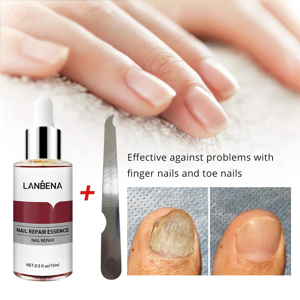 🔥 LIMITED DEAL — Lanbena Nail Repair Essence | Repairs + Strengthens + Promotes Nail Growth | KSh 2,200