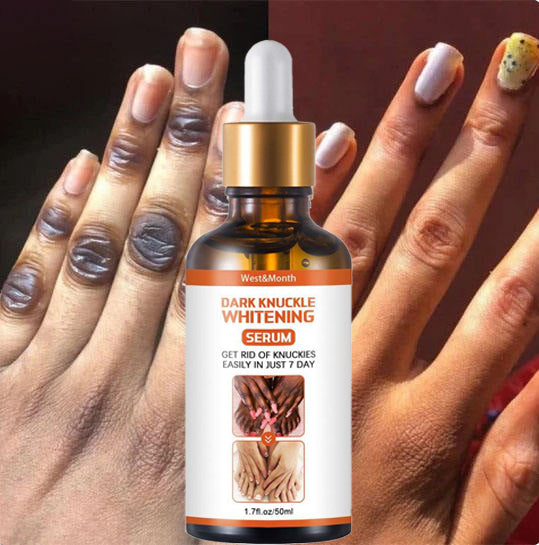 🔥 LIMITED DEAL — Vitamin C & Niacinamide Brightening Serum | Whitening + Dark Spot Fading + Anti-Aging | KSh 1,800