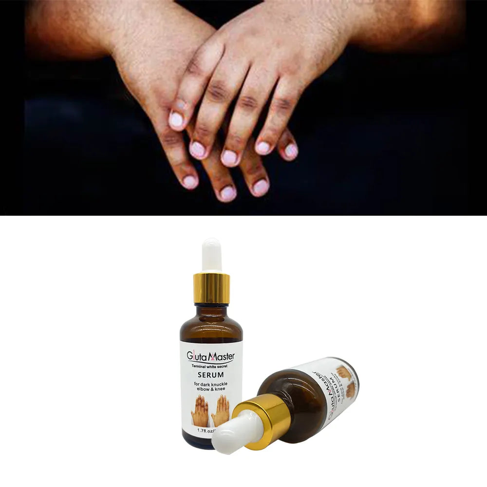 🔥 LIMITED DEAL — Gluta Master Brightening Serum | Fades Dark Knuckles + Lightens Knees & Elbows + Evens Skin Tone | KSh 1,700