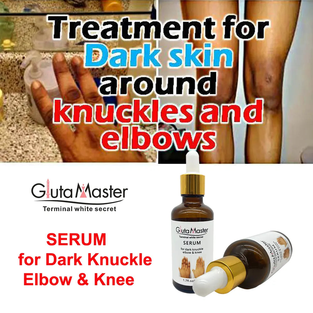 🔥 LIMITED DEAL — Gluta Master Brightening Serum | Fades Dark Knuckles + Lightens Knees & Elbows + Evens Skin Tone | KSh 1,700