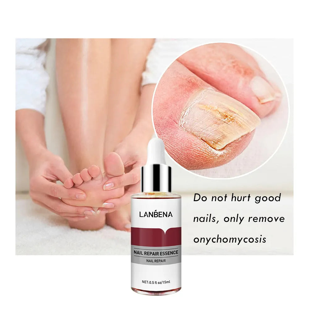 🔥 LIMITED DEAL — Lanbena Nail Repair Essence | Repairs + Strengthens + Promotes Nail Growth | KSh 2,200