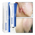 🔥 FLASH SALE — MOOYAM Acne Scar Removal Cream | Fade Dark Spots + Even Skin Tone | KSh 1,800