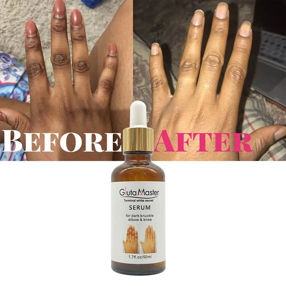 🔥 LIMITED DEAL — Gluta Master Brightening Serum | Fades Dark Knuckles + Lightens Knees & Elbows + Evens Skin Tone | KSh 1,700