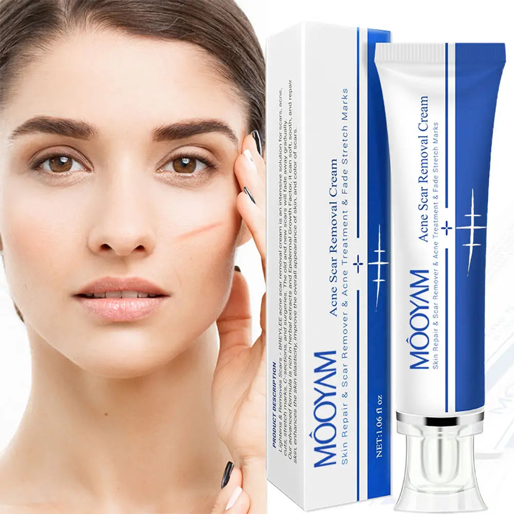 🔥 FLASH SALE — MOOYAM Acne Scar Removal Cream | Fade Dark Spots + Even Skin Tone | KSh 1,800