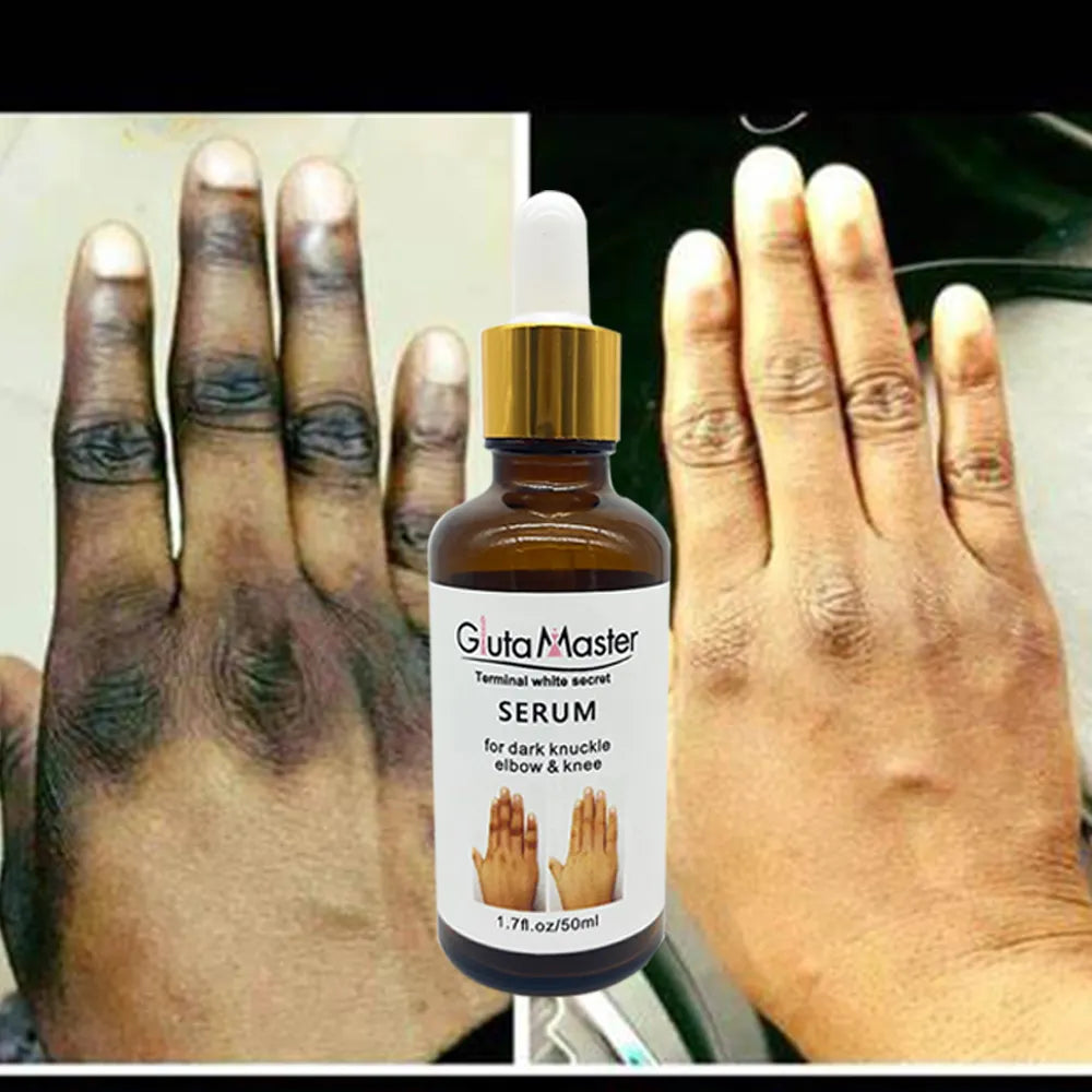 🔥 LIMITED DEAL — Gluta Master Brightening Serum | Fades Dark Knuckles + Lightens Knees & Elbows + Evens Skin Tone | KSh 1,700