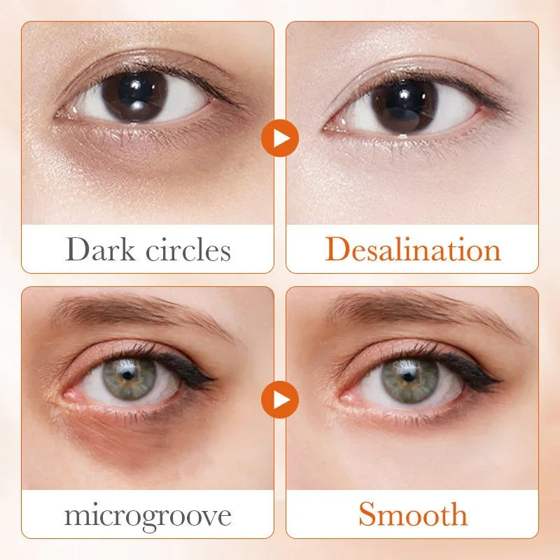 SADOER 5X Vitamin C Nicotinamide Firming Repairing Eye Cream Anti Dark Circles Eyes Bags Remover