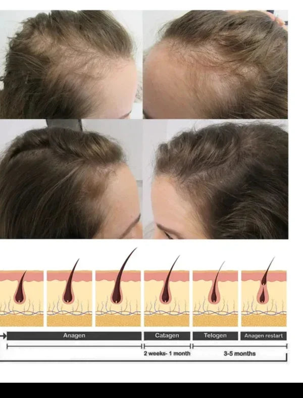 🔥 BUY 1 GET 1 FREE — King of Ginger 7-Day Hair Growth Oil | Stop Breakage + Regrow Hair | KSh 1,800 (C)