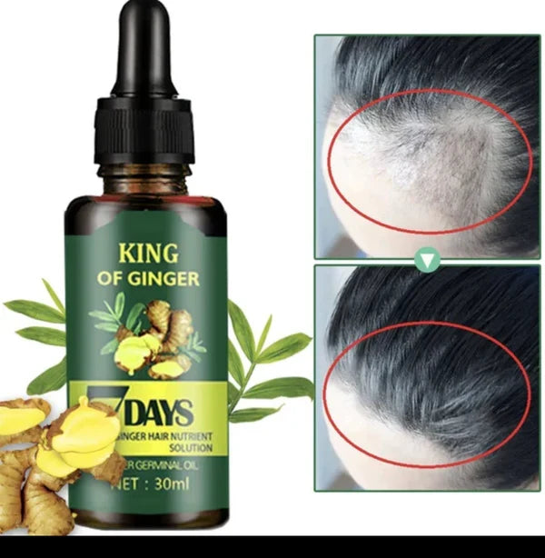 🔥 BUY 1 GET 1 FREE — King of Ginger 7-Day Hair Growth Oil | Stop Breakage + Regrow Hair | KSh 1,800 (C)