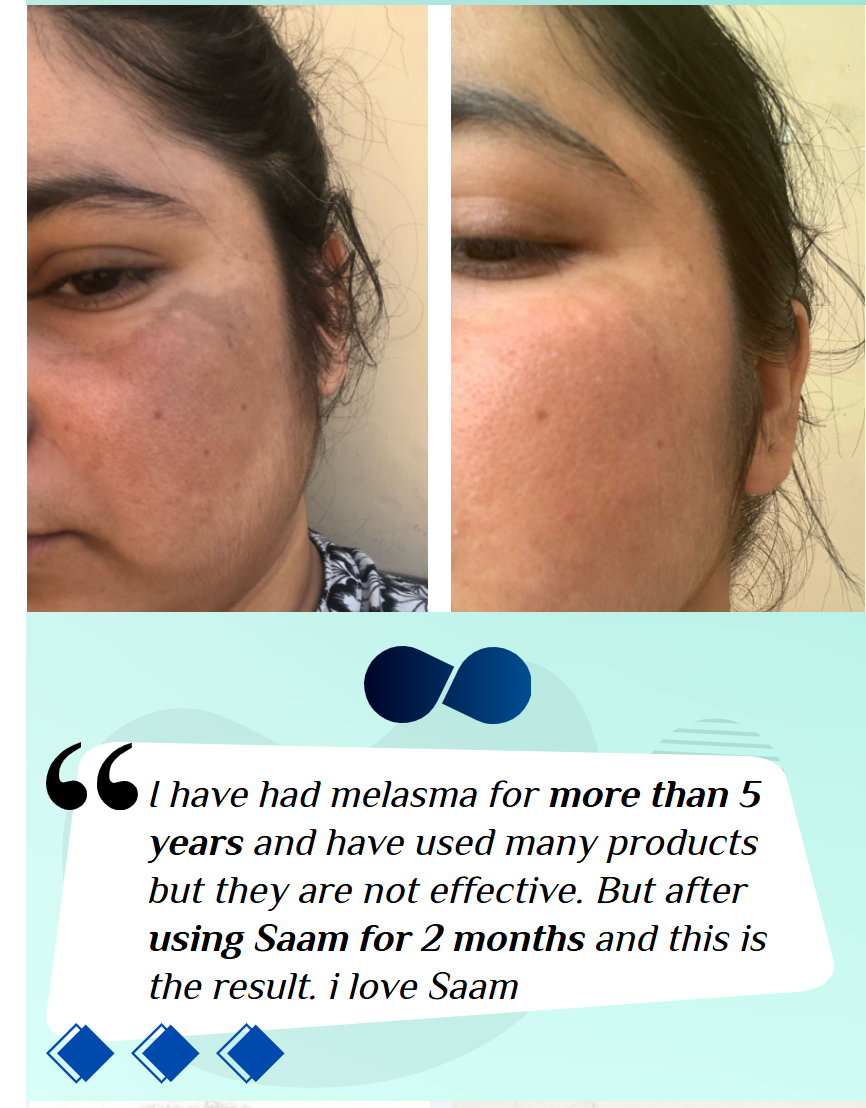 🔥ORIGINAL Saam Renewal Face Cream with QR CODE , BUY 1 GET 1 EXTRA FREE 🔥