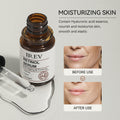 🔥 LIMITED DEAL — IREV Retinol Serum 30ml | Anti-Wrinkle + Collagen Boost + Dark Spots + Glow | KSh 1,800
