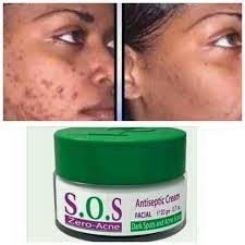 🔥 SALE — Pharmaderm SOS Zero Acne Antiseptic Cream | Kill Acne Bacteria + Fade Dark Spots | KSh 1,600