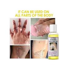🔥 LIMITED DEAL — O'Carly Extra Strong Peeling Oil | Deep Exfoliation + Fades Dark Spots + Reveals Glowing Skin | KSh 1,800
