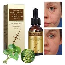 🔥 LIMITED DEAL — Pei Mei Collagen Scar & Acne Mark Removal Repair Essence 30g | Fades Scars & Acne Marks + Boosts Collagen + Repairs & Smooths Skin | KSh 1,200