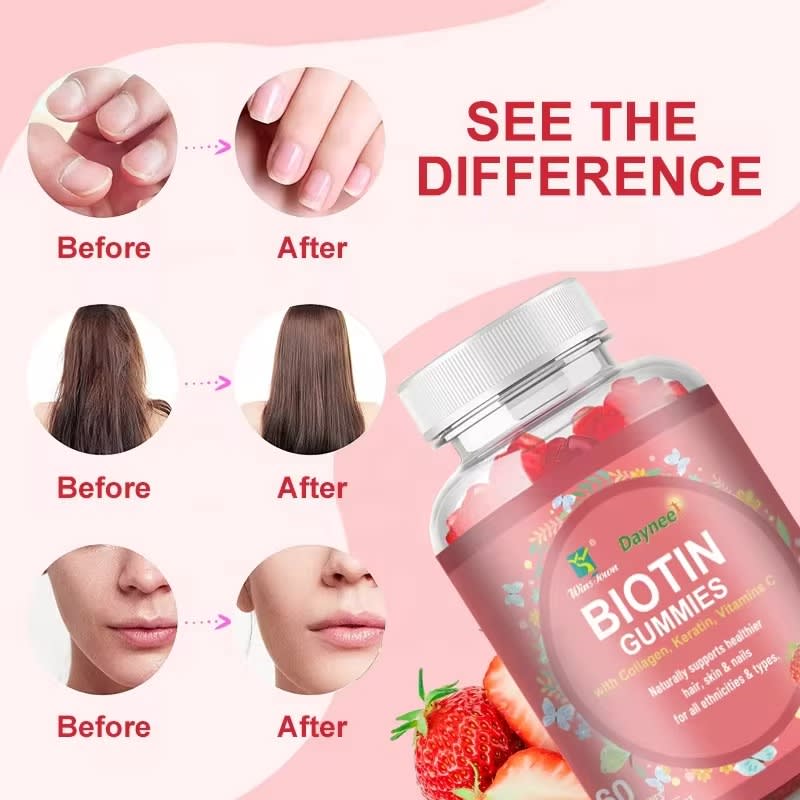 🔥 LIMITED DEAL — DAYNEE Biotin Keratin Collagen Gummies | Thicker Hair + Glowing Skin + Strong Nails | KSh 1800