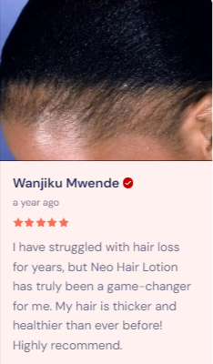 🔥 LIMITED DEAL — Neo Hair Lotion (Thailand) | Stops Hair Loss + Regrows + Strengthens Roots | KSh 4,500
